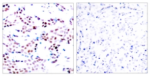c-Jun (Phospho-Thr91) antibody