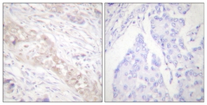 Smad2 (Phospho-Ser467) antibody