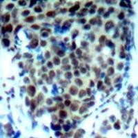 P38 MAPK (phospho Thr180) Antibody