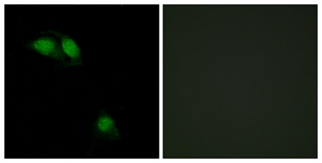IRS-1 (Phospho-Ser312) antibody