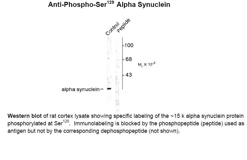 Alpha synuclein (phospho Ser129) Antibody