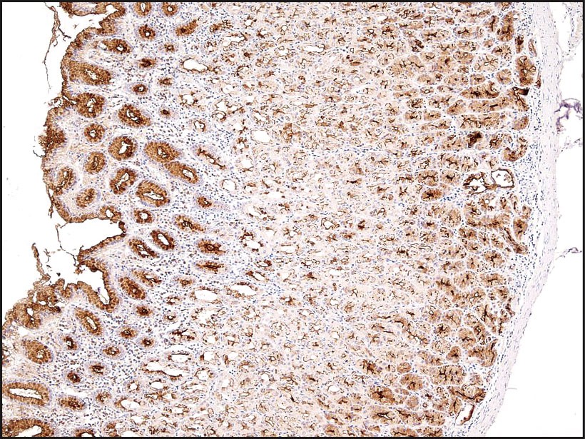 Mucin 1 Antibody