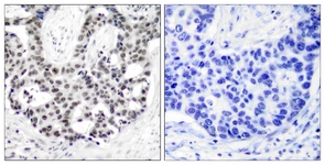 Androgen Receptor (Phospho-Ser650) antibody