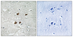 HSF1 (Phospho-Ser121) antibody