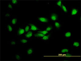 MDS028 Antibody (monoclonal) (M05)