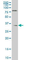 NKX6-1 Antibody (monoclonal) (M01)