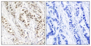 BRCA1 (Phospho-Ser1524) antibody