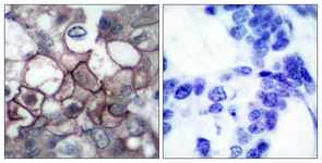EGFR (Phospho-Tyr1197) antibody