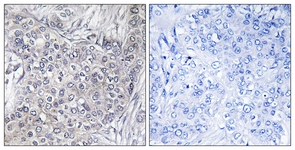 4E-BP1 (Phospho-Thr45) antibody