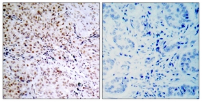 Retinoblastoma (Phospho-Ser795) antibody