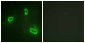 p90 RSK antibody