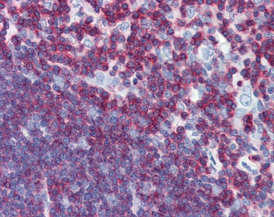 CD45 Antibody