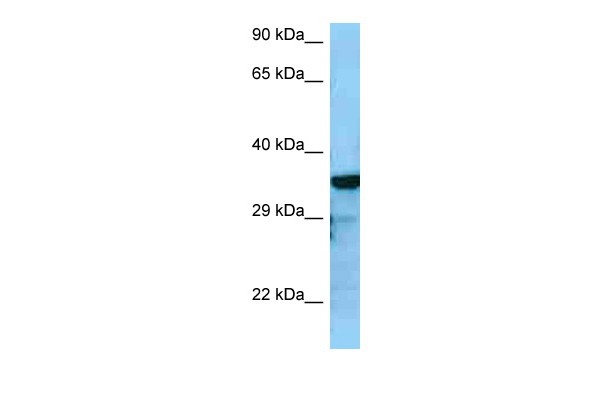 RGS4 antibody