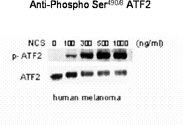 ATF2 (phospho Ser 490 / 498) Antibody