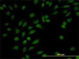 NR3C1 Antibody (monoclonal) (M01)