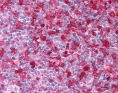 SYK Antibody