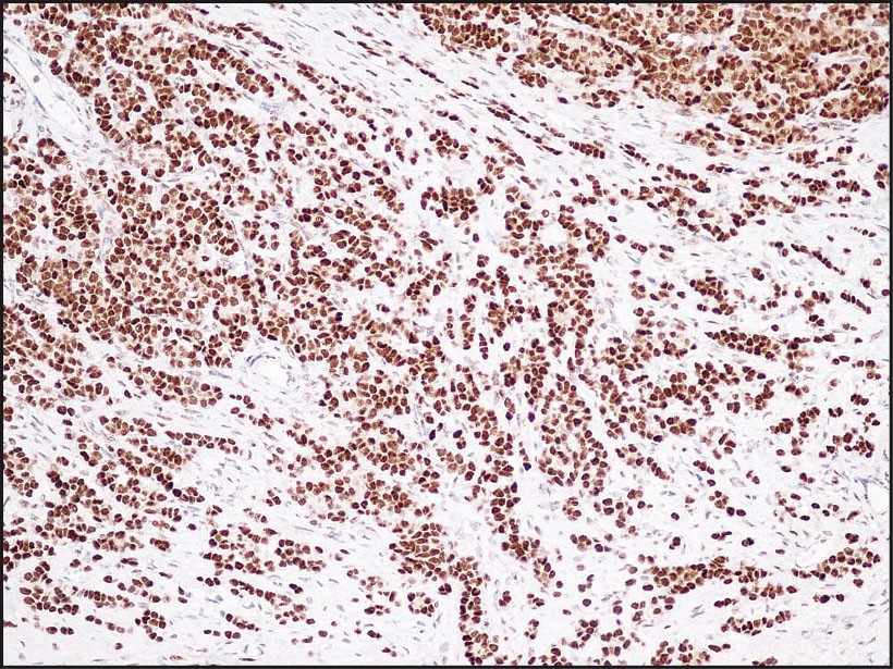 Estrogen Receptor Alpha Antibody