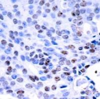 NFkB p105 / p50 Antibody