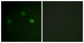 CDK1/CDC2 (Phospho-Thr14) antibody