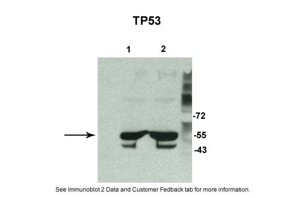 TP53 antibody - N-terminal region