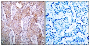 EGFR (Phospho-Ser1070) antibody