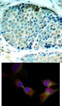 HSP27 (phospho Ser78) Antibody