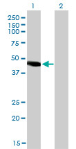 NR2E3 Antibody (monoclonal) (M01)