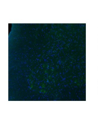 HTR2B antibody - N-terminal region