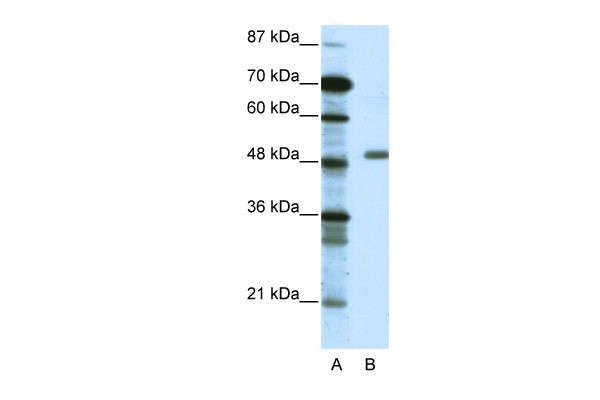 TADA3L antibody - middle region