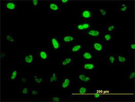 NEUROD1 Antibody (monoclonal) (M01)