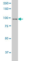 NBN Antibody (monoclonal) (M01)