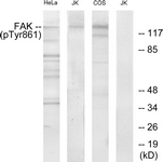 FAK (Phospho-Tyr861) antibody