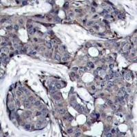 HSP27 (phospho Ser82) Antibody
