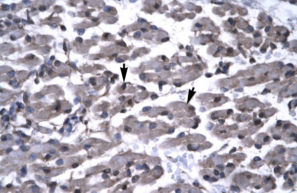 PAWR antibody - middle region