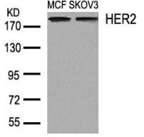 HER2 Antibody