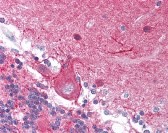 Stathmin 1 Antibody