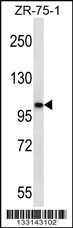 AR Antibody