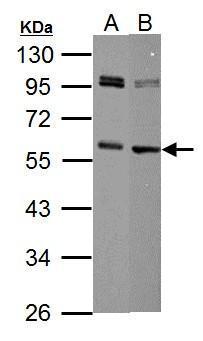 c-Myc (phospho Thr58) antibody