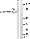 Tau (Phospho-Ser519/202) antibody