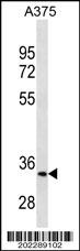 MC1R Antibody (Center)