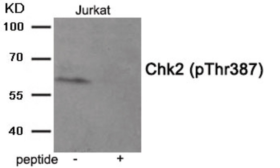 Chk2 (phospho Thr387) Antibody