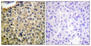 KIT (Phospho-Tyr703) antibody