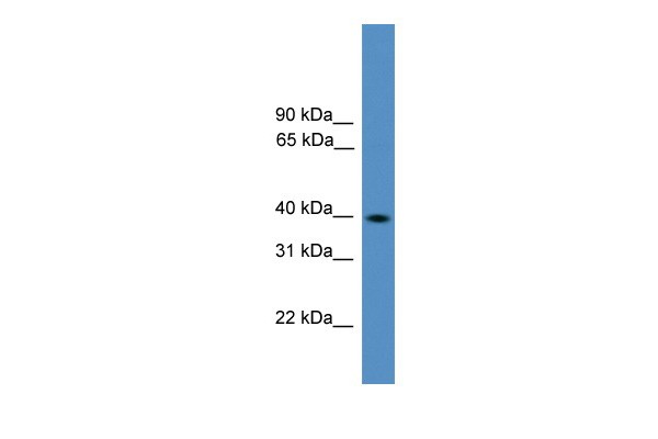 Pax2 antibody