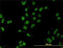 MEOX2 Antibody (monoclonal) (M03)