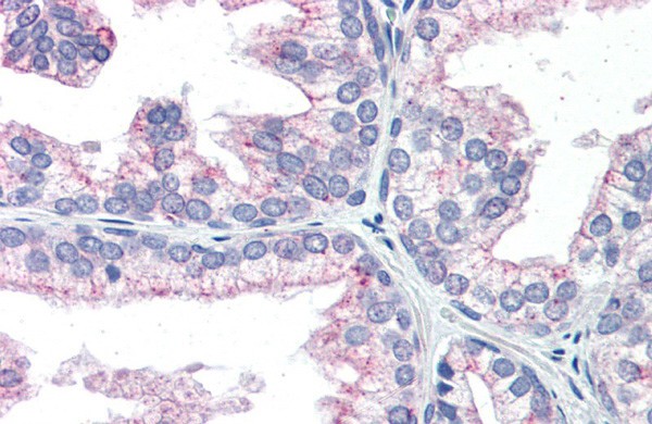 NAB1 antibody - N-terminal region