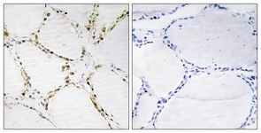 FOXO1A/3A antibody
