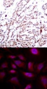 ATF2 (phospho Thr73 / 55) Antibody
