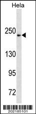 NOTCH3 Antibody (C-term Q2306) (Ascites)