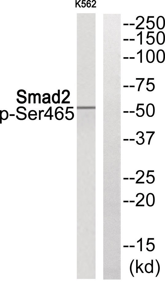 Smad2 (phospho Ser465) Antibody