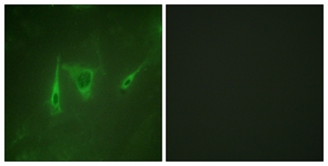 14-3-3 zeta/delta antibody